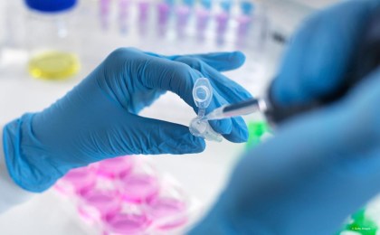 На 12.04.2020 в Беларуси зарегистрировано 2578 человек с наличием коронавирусной инфекции