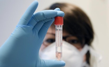 5 мая: в Беларуси зарегистрированы 18350 человек с положительным тестом на COVID-19