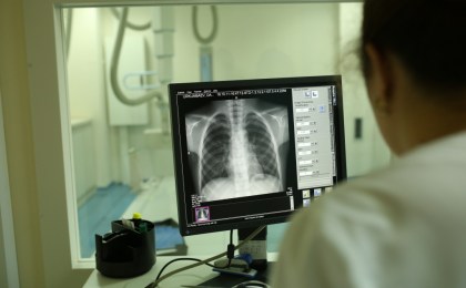 с 17 по 20 июля кабинет флюорографии в поликлинике Кобрина будет работать до 13.00