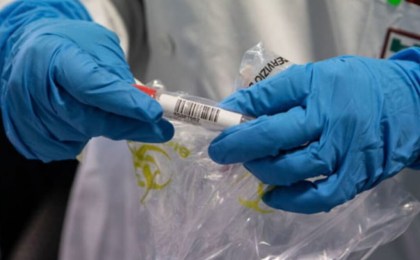 Число умерших от коронавируса в мире превысило 1 млн