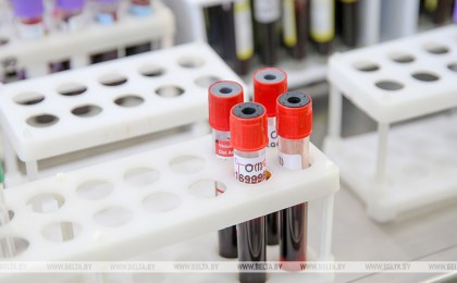 Более 1,2 тыс. новых случаев ВИЧ-инфекции зарегистрировано в Беларуси за январь-октябрь. В Брестской области выявлено 105 случаев
