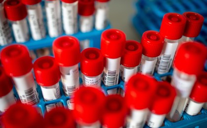 О профилактике заболеваемости COVID-19 в коллективах обсудили на заседании рабочей группы 3 декабря