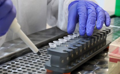 В Беларуси началась массовая вакцинация российским препаратом от коронавируса «Спутник V»