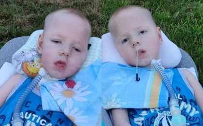 «Круглосуточно на ИВЛ». Тяжелобольным двойняшкам с СМА необходим откашливатель