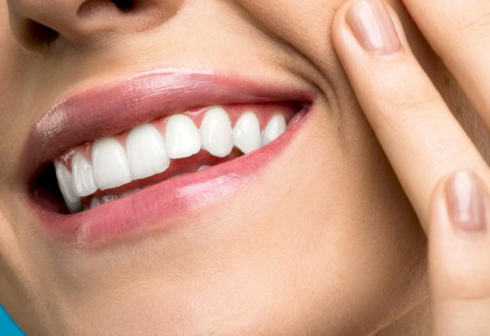 Ослепительная улыбка или риск для эмали? Что нужно знать о домашнем отбеливании