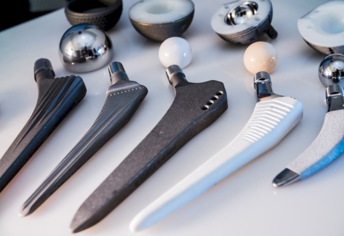 Стало известно, как долго в Беларуси ожидают замены тазобедренных суставов